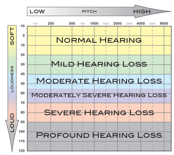 audiogram