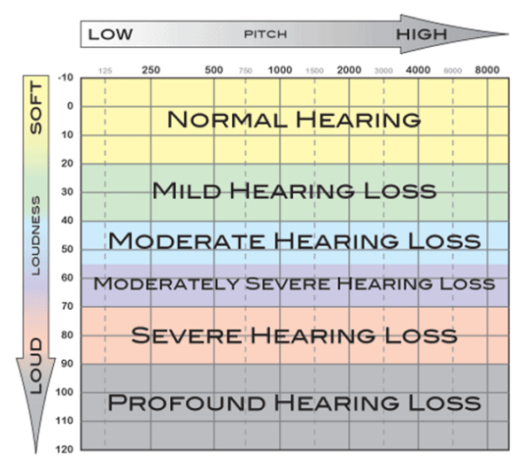 audiogram